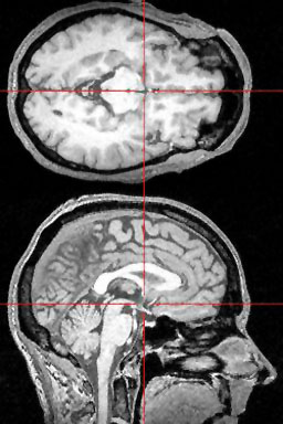 if image