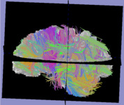 Diffusion MRI / Ali Bilgin